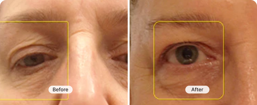 result image 1