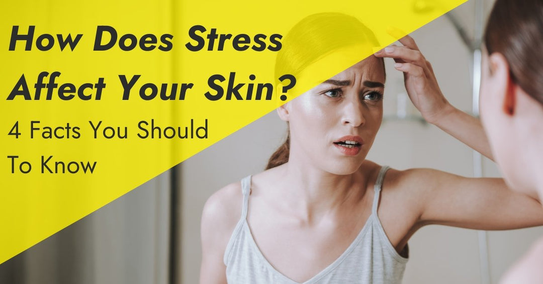 4 Facts To Know About Stress and Your Skin - 7E Wellness