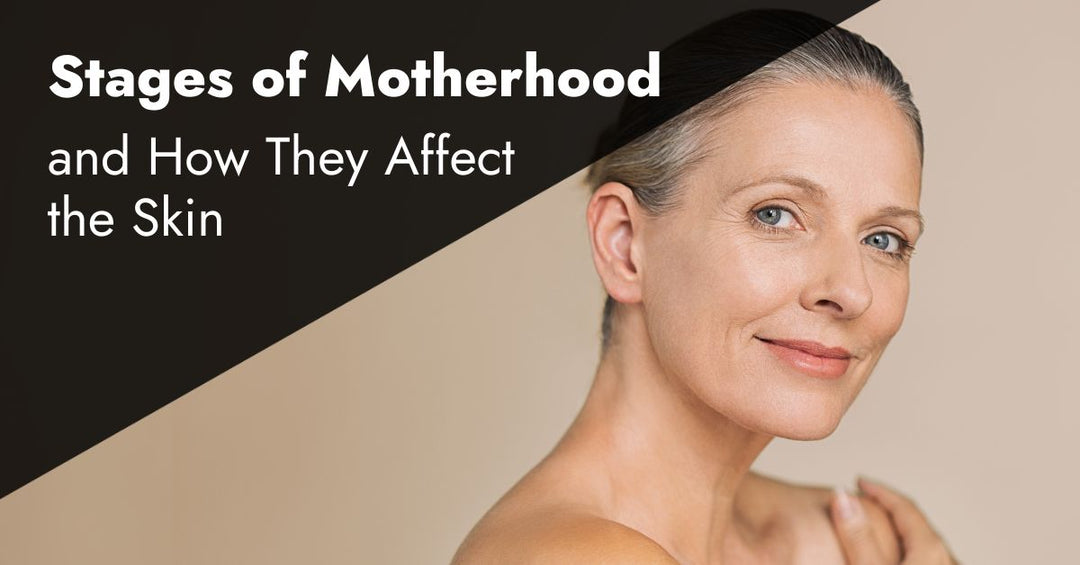 stages of motherhood and how they affect skin