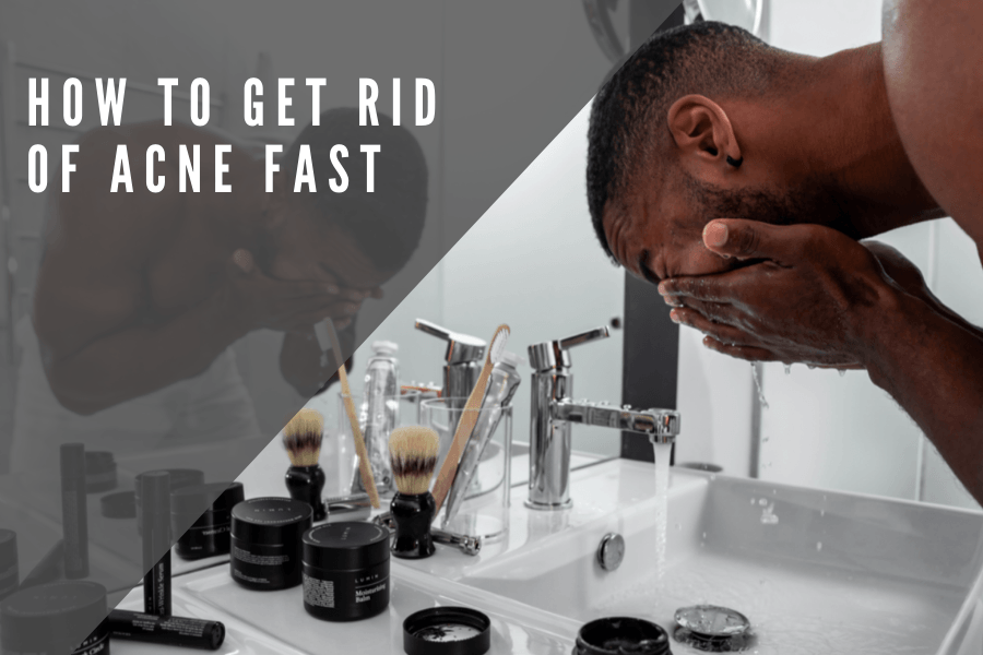 How to Get Rid of Acne Fast - 7E Wellness
