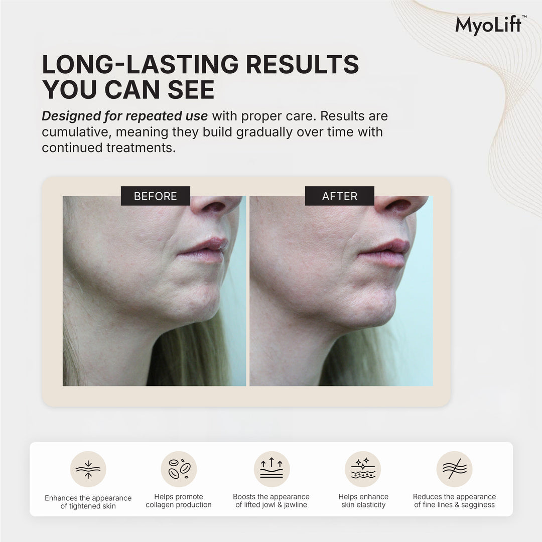 MyoLift Jowl Mask for Effective Jowl Lifting