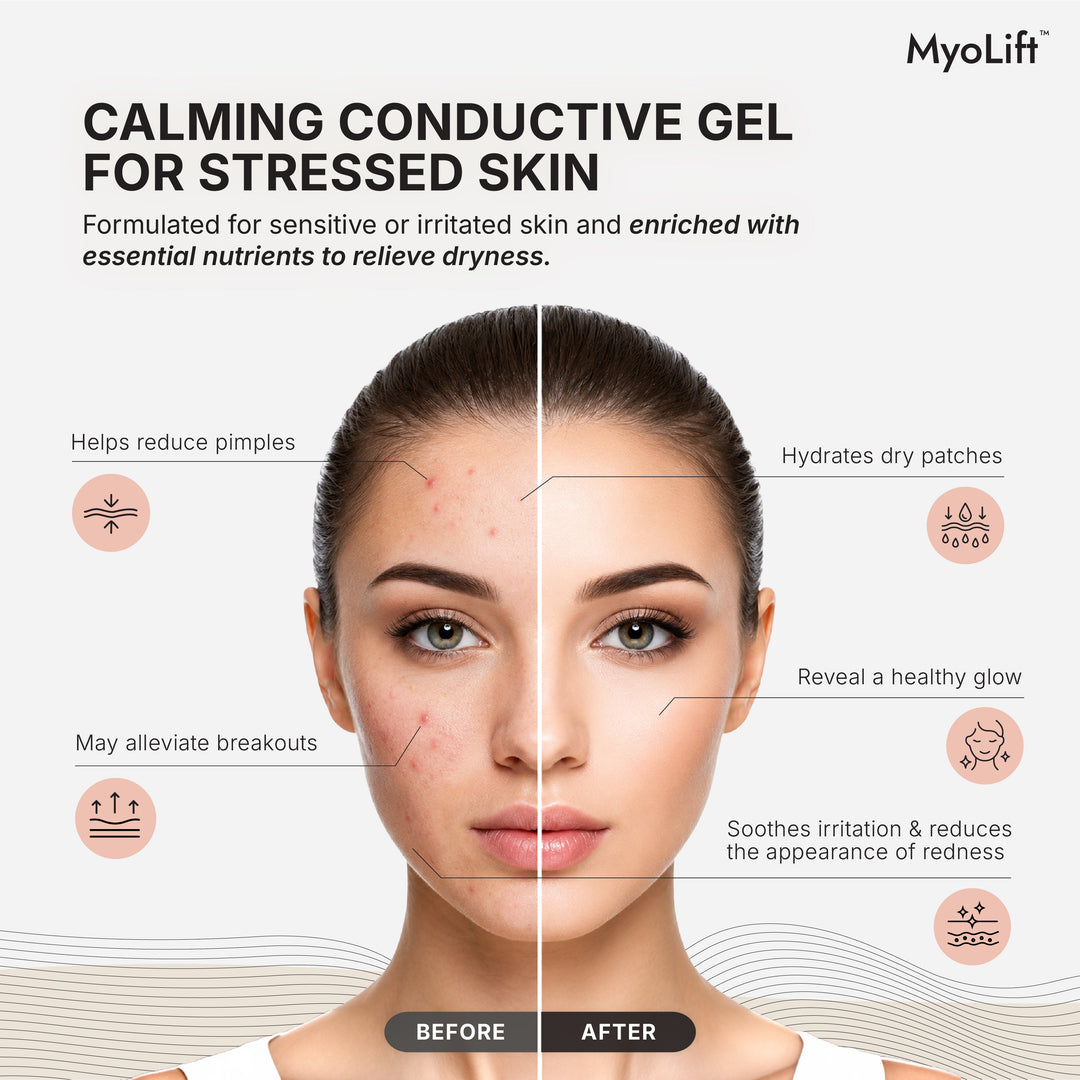 16oz ReNu Conductive Tx Gel For Stressed Skin with Bio-Active Complex