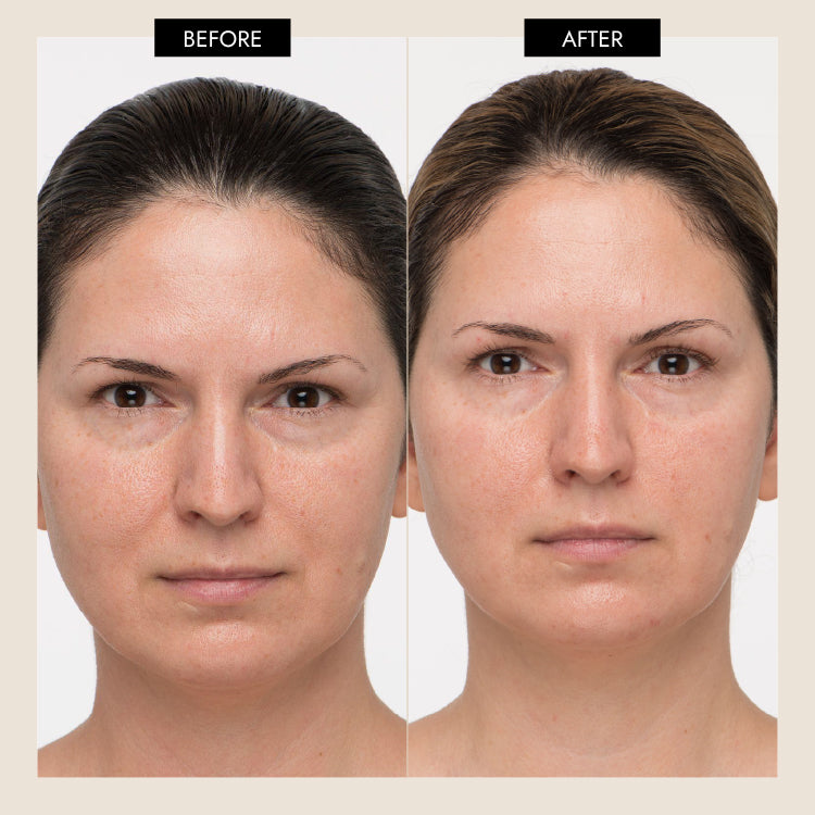Ozempic Face: The Effects of GLP-1 and Weight Loss on Facial Skin and – 7E Wellness