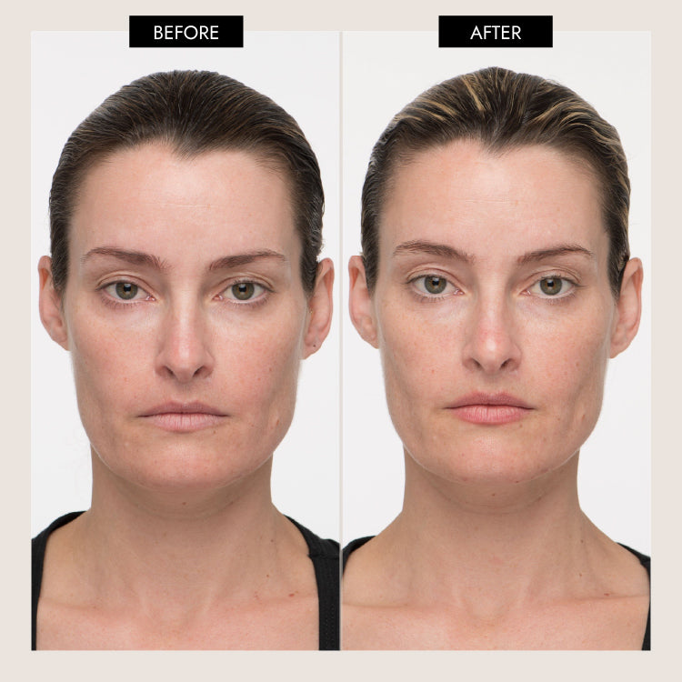 Safety Tip on microcurrent facial treatment and Thyroid – 7E Wellness