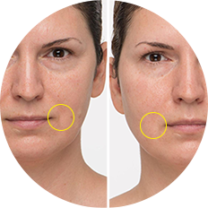 %20Image%20demonstrating%20how%20our%20peptide%20serum%20helps%20smoothen%20fine%20lines.