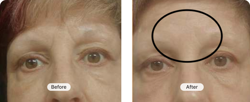 result image 8