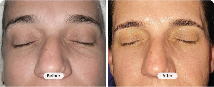 result image 3