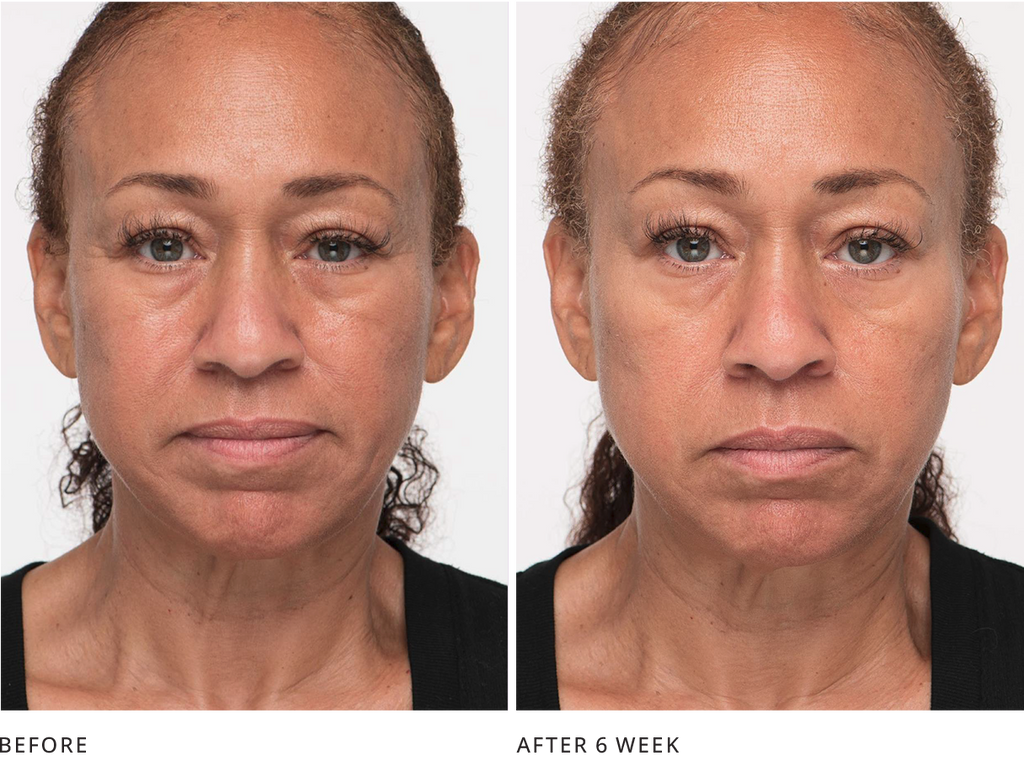 Reaction From Microcurrent Microcurrent Facial Clinical Study Research and Result – 7E Wellness
