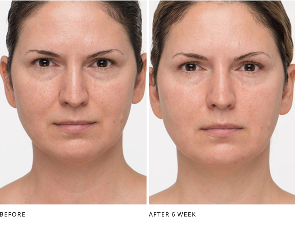 7e Microcurrent Microcurrent Facial Clinical Study Research and Result – 7E Wellness