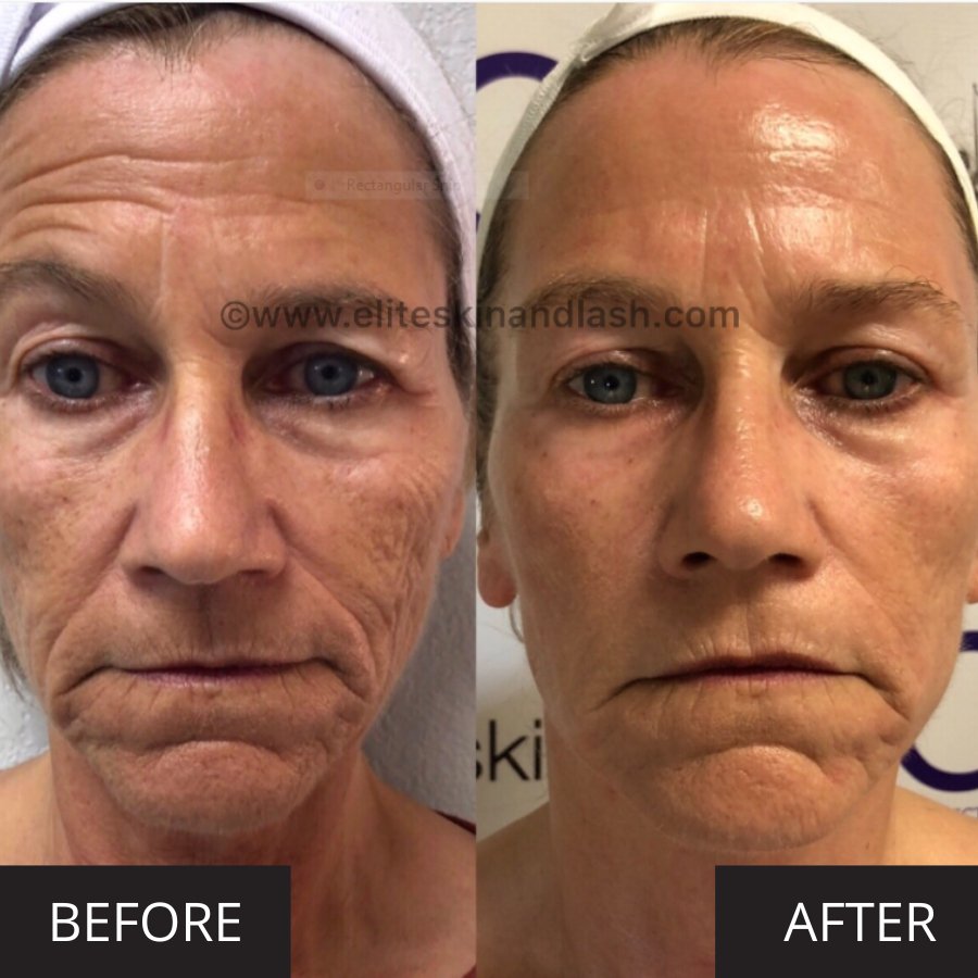 The Difference between Microcurrent & Radio Frequency 7E Wellness